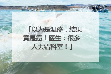 以为是湿疹，结果竟是癌！医生：很多人去错科室！